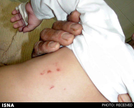 شکنجه کودک در دخمه معتادان +عکس