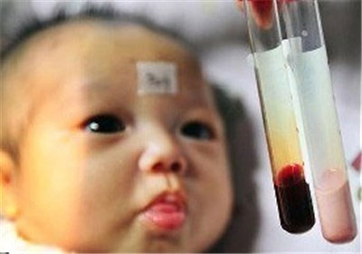 نوزادی که خونش صورتی است +عکس