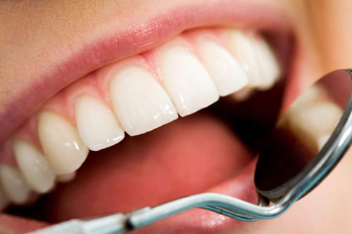 5 راهکار ساده برای داشتن دندان‌های سالم