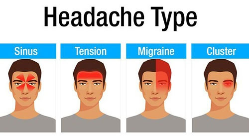 چطور سردردهای شایع را بشناسید/از سردرد سینوسی تا میگرن
