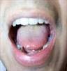 چند راهكار برای درمان خشكی دهان