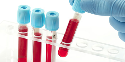 تفسیر نتایج آزمایش , آزمایش خون