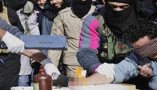 داعش دست یک سوری را قطع کرد +عکس