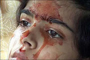 تصاویر شگفت انگیز دختری که خون گریه می کند!