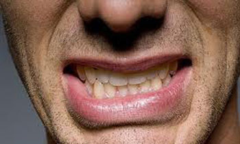 دندان‌قروچه, درمان دندان قروچه