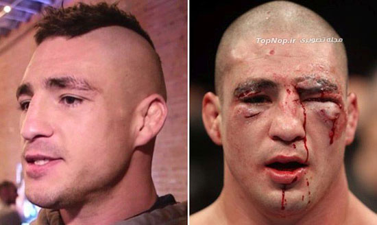 چهره ورزشکاران رزمی UFC قبل و بعد از مسابقه +عکس
