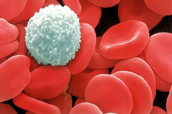 امکان تشخیص زودهنگام و ارزان سرطان خون