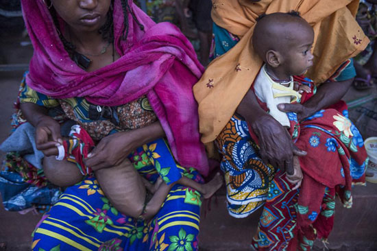 بحران سوء‌تغذیه کودکان افریقای‌مرکزی