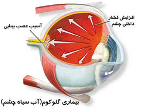 بیماری‌های چشمی, چشم پزشکی, درمان بیماری