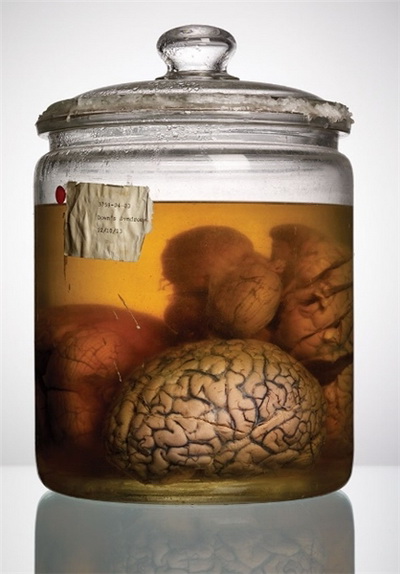 تصاویری از بایگانی مغز انسان طی 50 سال