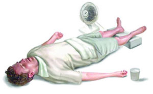 درمان گرمازدگی, گرمای تابستان