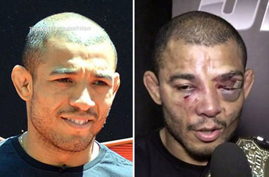 چهره ورزشکاران رزمی UFC قبل و بعد از مسابقه +عکس