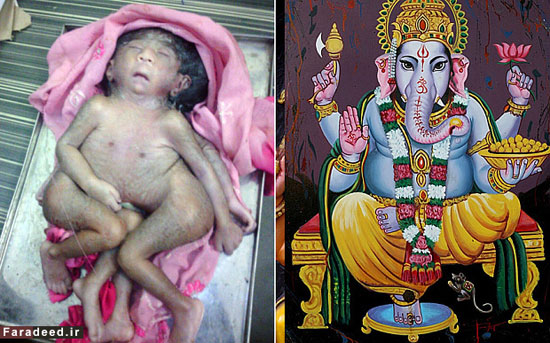 پرستش کودک ناقص الخلقه هندی