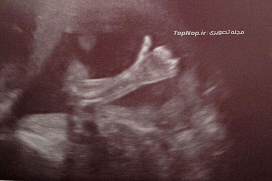 تصاویر جالب از سونوگرافی یک خانم حامله!