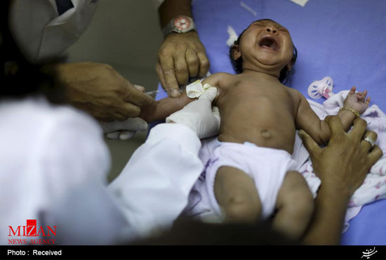 نوزادان مبتلا به ویروس زیکا