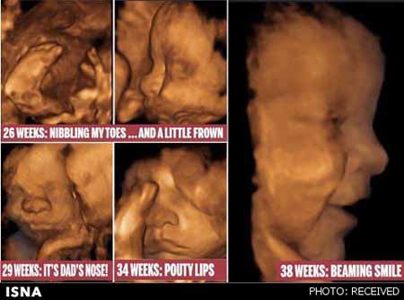 اخبار,اخبار علمی,تصاویر سه بعدی جنین
