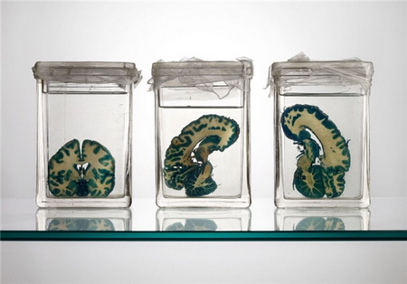 تصاویری از بایگانی مغز انسان طی 50 سال