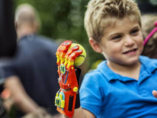 دست سه بعدی چاپ شده به پسر 6 ساله متصل شد