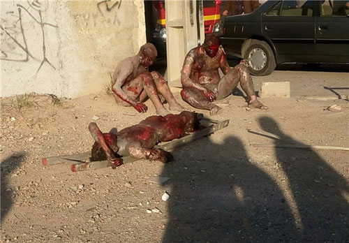 تصاویر دلخراش از انفجار در اسلامشهر (18+)