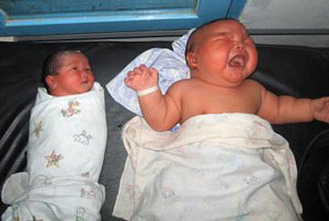تولد نوزاد غول پیكر در اندونزی