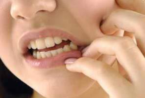 دندان‌ درد, بهداشت دهان و دندان, پوسیدگی‌ دندان
