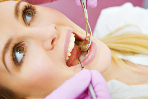 پنج سوالی که درباره عصب کشی دندان می پرسند