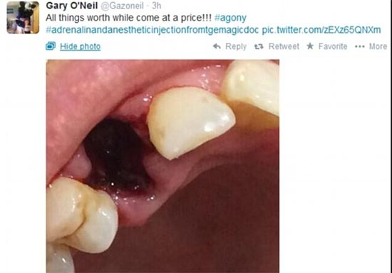 دندان کنده شده بازیکن کوئینز پارک رنجرز در آسمان +عکس