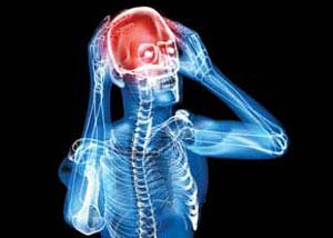 تاثیر منفی, عوامل سردرد, پیشگیری از سردرد
