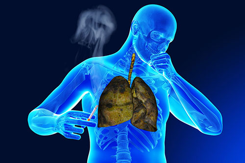 روش های درمان سرفه در افراد سیگاری