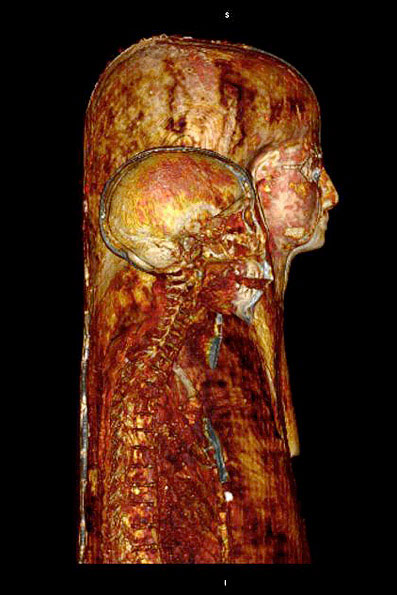  تصاویری از اسکن مومیایی 3 هزار ساله, اسکن مومیایی 3 هزار ساله
